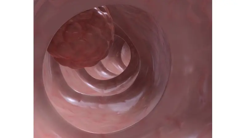 No description available