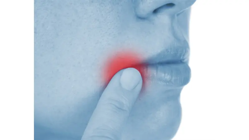 No description available