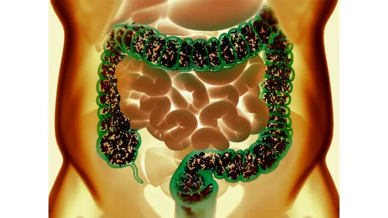 No description available