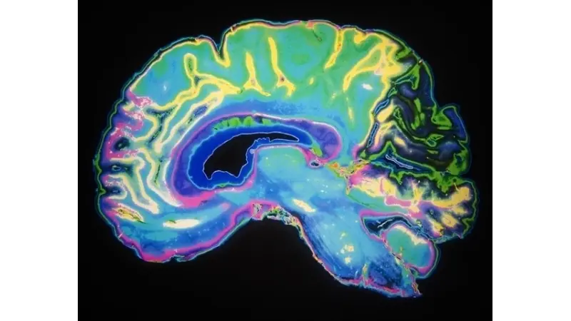 No description available